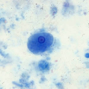 <p>3-12 um, 1 nucleus. No ingested RBC</p>
