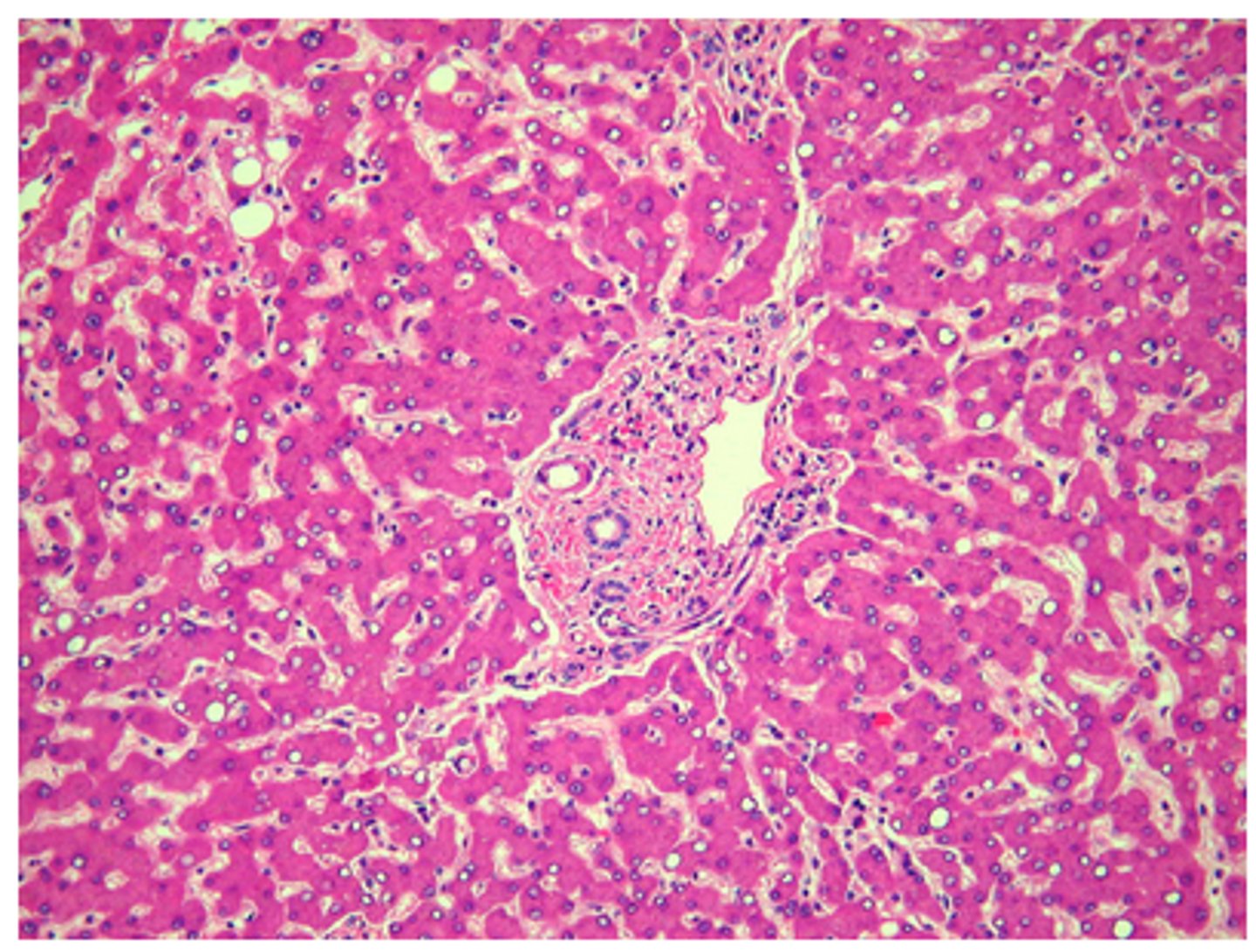 <p>PAS with and without digestion</p><p>Feedback:</p><p>This is a section of liver and is frequently chosen as a control for glycogen demonstration (PAS with and without diastase). It would not be a control tissue for the other techniques; there is no amyloid or mucin present.</p>