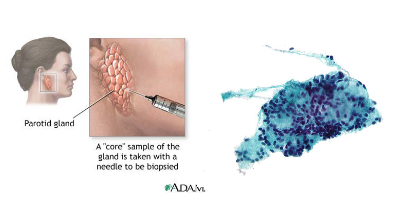 <ul><li><p>physical examination</p></li><li><p>CT</p></li><li><p>MRI</p></li><li><p>ultrasound</p></li><li><p>fine needle aspiration (FNA) - core sample of gland is taken with needle </p></li><li><p>biopsy </p></li></ul><p></p>