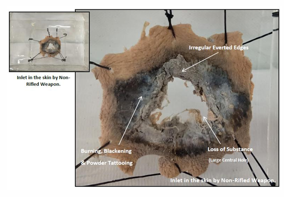 <p></p><div data-type="horizontalRule"><hr></div><p>Questions</p><ol><li><p>What is the specimen being examined?</p></li><li><p>What are the specific descriptive features of the wound edges, diameter, and dispersion?</p></li><li><p>What specific features indicate a "near firing" range?</p></li><li><p>How is the antemortem nature of this injury determined?</p></li><li><p>What type of causative instrument produced this injury?</p></li><li><p>How is the time of death estimated?</p></li><li><p>What are the possible causes of death?</p></li><li><p>What is the final diagnosis?</p></li></ol><div data-type="horizontalRule"><hr></div><p></p>