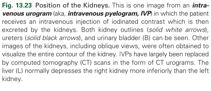 <p>kidneys</p>