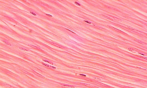 <p>what muscle tissue is this? </p>