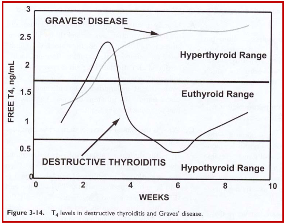 <p>First things first: Acute (destructive) thyroiditis is NOT the same as Hashimoto’s</p><p>thyroiditis</p><p></p><p>In acute thyroiditis, here is an initial presentation of hyperthyroidism which is followed by a hypothyroid phase and then recovery of thyroid function</p>