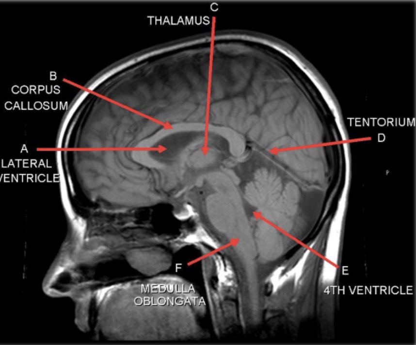 <p>What image is this?</p>