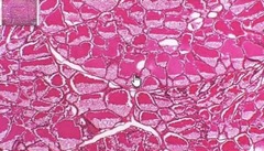 <p>give anatomical name, histological classification, and secretion of gland shown</p>