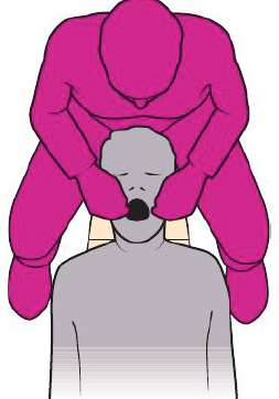 <p><strong>Torso position</strong></p><ul><li><p>Behind patient’s head</p></li></ul><p><strong>Leg position</strong></p><ul><li><p>Straddle headrest</p></li></ul><p><strong>Arm positions</strong></p><ul><li><p>Wrist and hands above patient’s ears and cheeks</p></li></ul><p><strong>Line of vision</strong></p><ul><li><p>Straight ahead into patient’s mouth </p></li></ul><p></p>