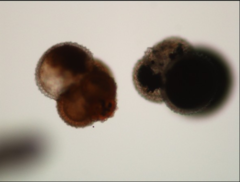 <p>give genus</p>