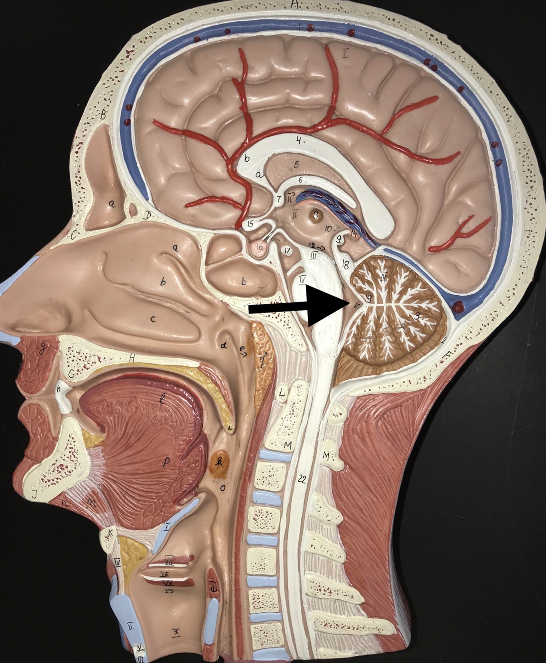 <p>What is the space the arrow is pointing to?</p>