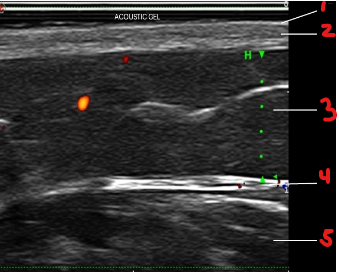 <p>Identify this image. </p>