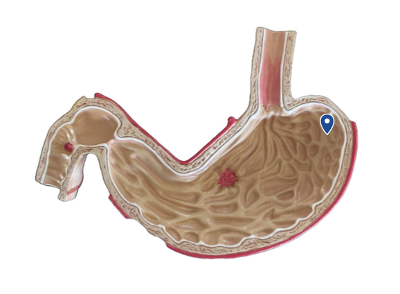 <p>Name this region of the stomach.</p>
