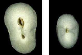 <p>30% of mandibular canines may have 2 canals, of the 30%, what percent have <strong>2 canals that join?</strong></p>