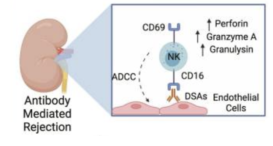 <p>Protective mechanisms</p><p>Nk cells learn waht self is via MHC an inhibitory olecules during development</p><ul><li><p>Recipeitn NK cells recognize missing self on donor apcs = hinders direct allorecognition (protective)</p><ul><li><p>non-self MHC may act as an activating lignad for NK cells</p></li></ul></li></ul><p>rejection mechanisms</p><ol><li><p>non-immune cells in the graft dont express recipeint-MHC</p></li></ol><p>Mechanisms that mediate rejection</p><ul><li><p>non-imune cells in the graft also doesnt express recipient-MHC</p></li><li><p>Donor-specific antibodies (DSAs) against vasculatore can trigger ADCC</p><ul><li><p>other mechanisms may also be involved = imbalance and activating and inhibitory receptors </p></li></ul></li></ul><p></p>