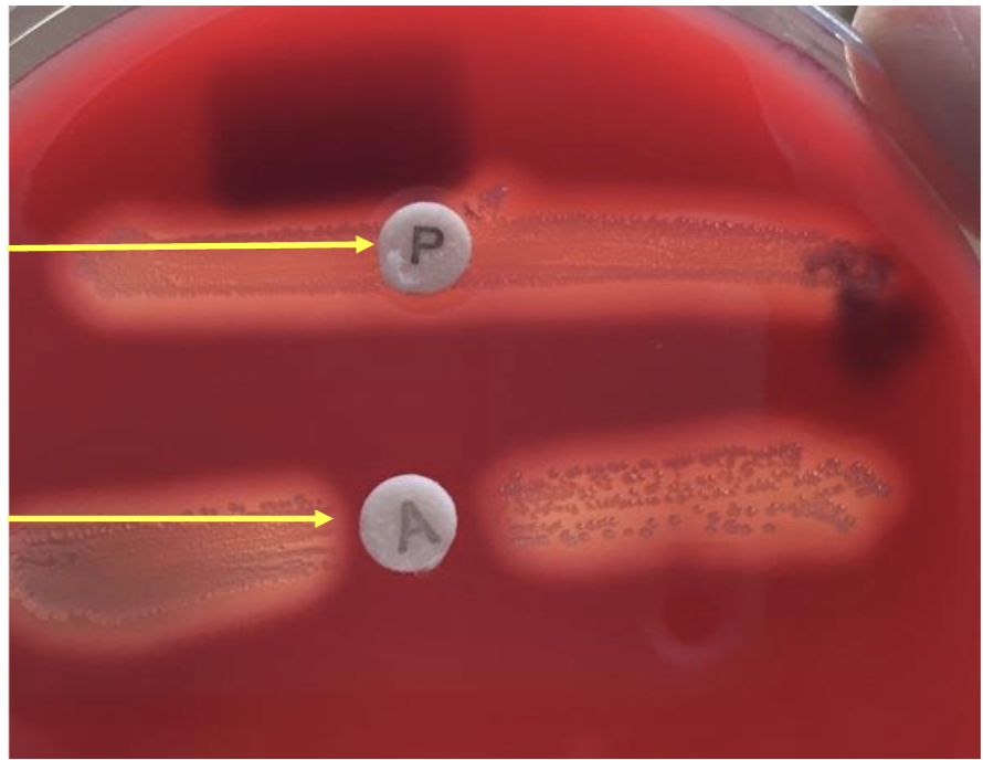 <p>what hemolysis is this?</p>
