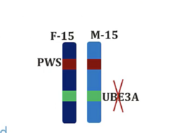 <p>- UBE3A gene which normally codes E3 ubiquitin ligase (needed for degradation of specific brain proteins so loss of expression causes cognitive/motor defects)</p>
