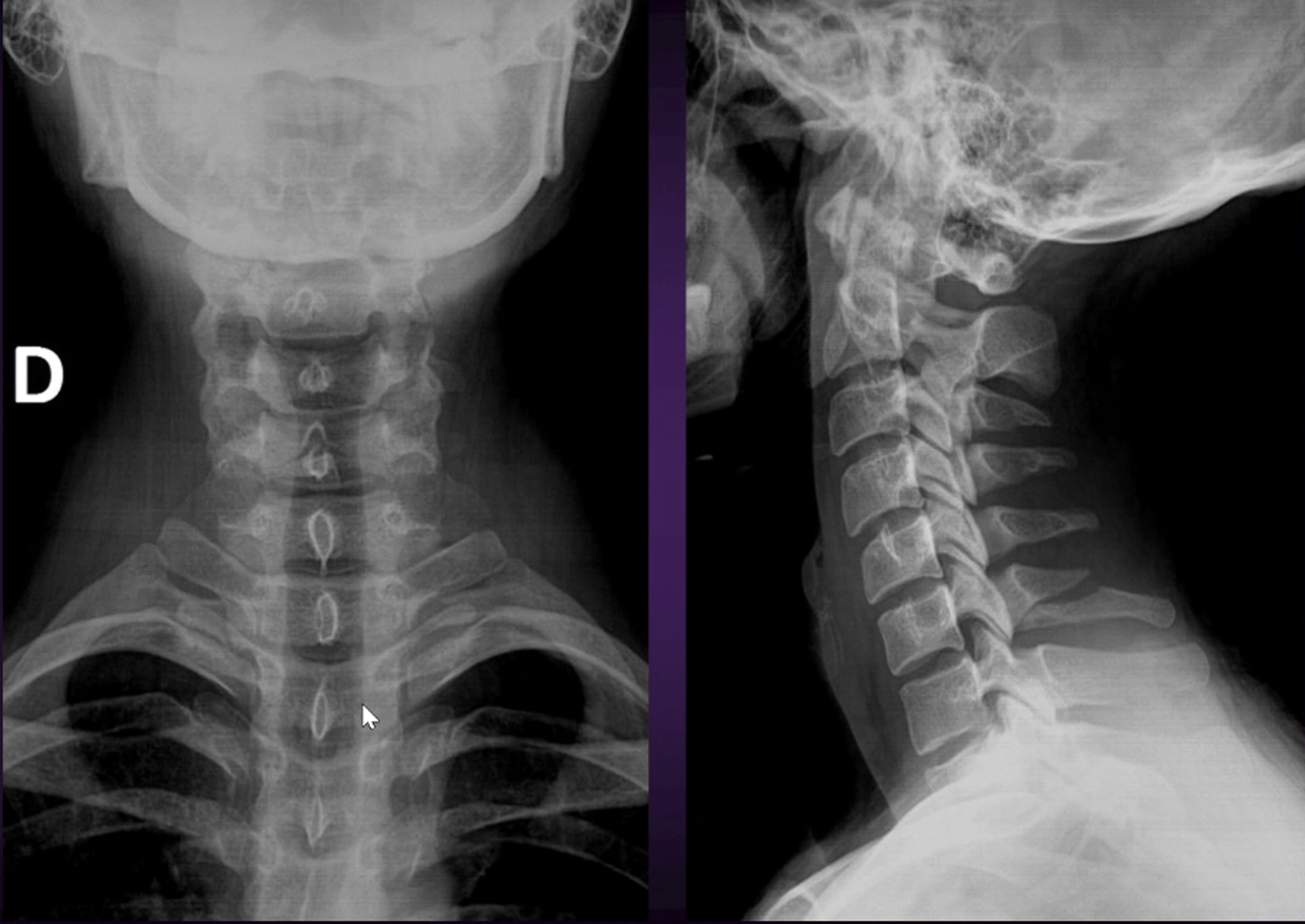 <p>What is the finding &amp; diagnosis?</p>