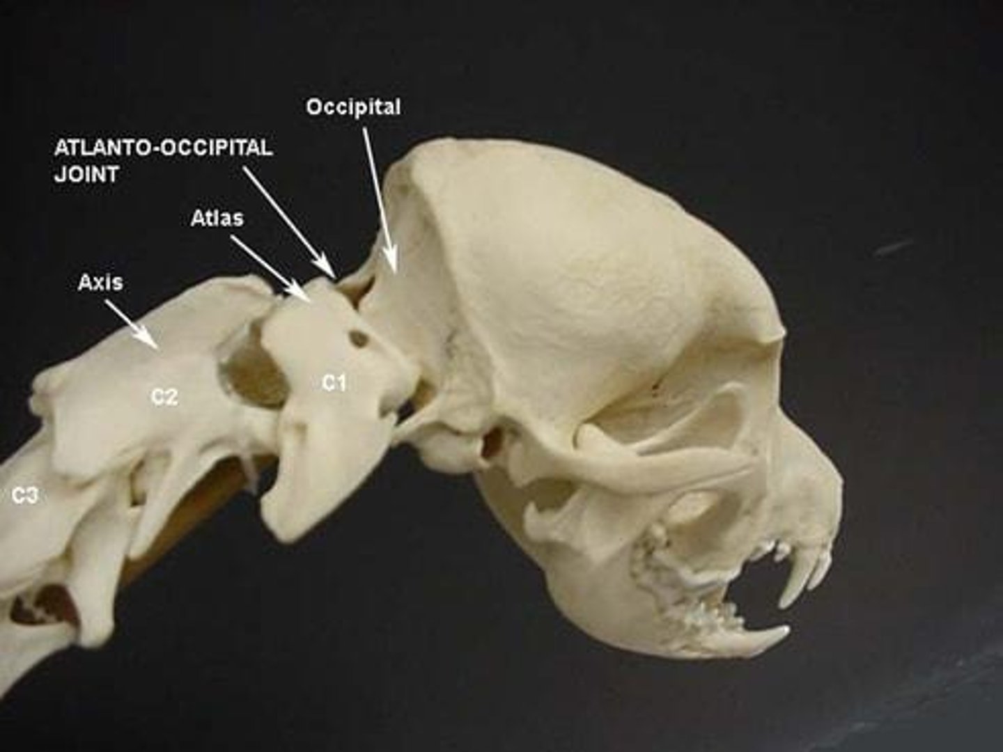 <p>A condition caused by transection of the spinal cord at the second lumbar vertebra, leading to front limb stiffness and hind limb paralysis.</p>