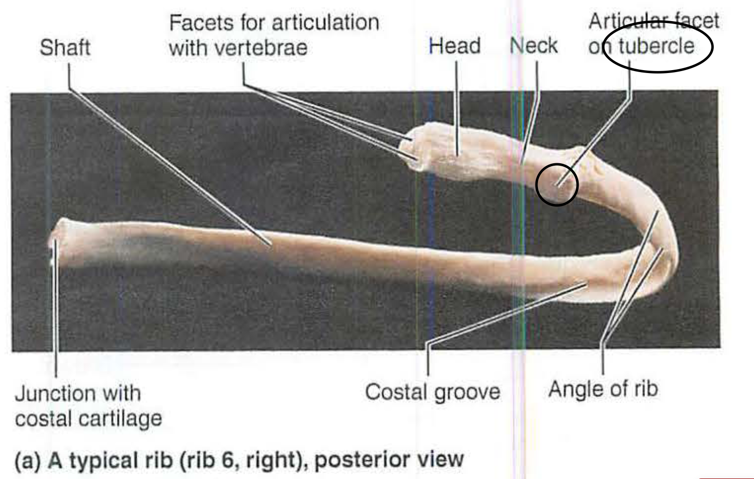 <p>c. tubercle</p>