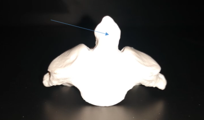 <p>What is this bone?</p>