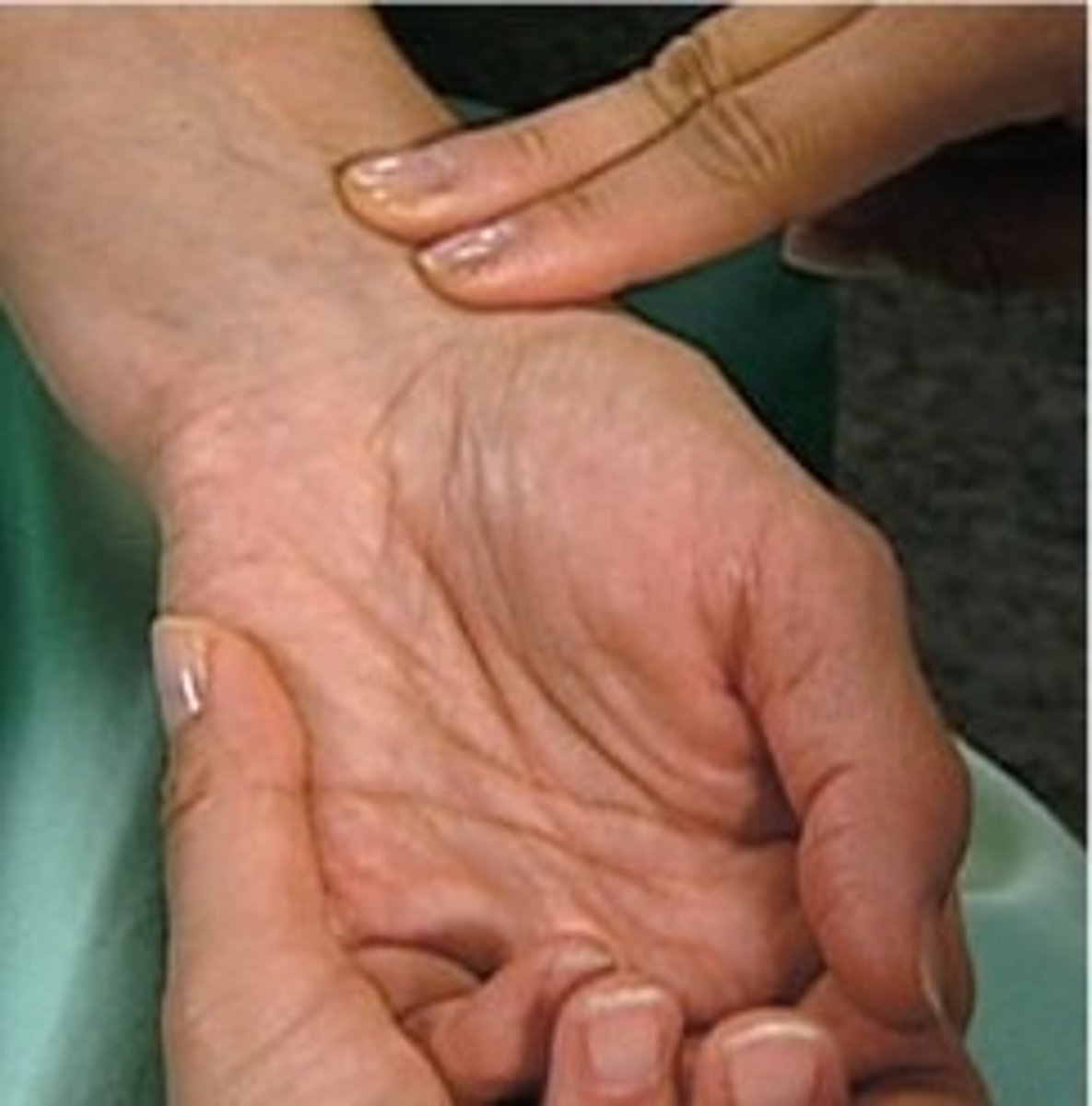 <p>Located at the wrist on the thumb side</p>