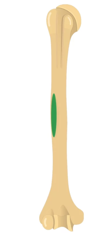 <p>What is this pointing to? What bone is it on?</p>