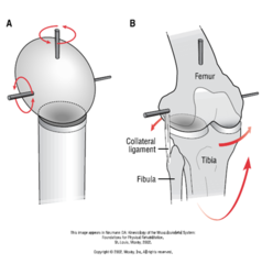 <p>- flattened socket</p><p>- 2 degrees of freedom </p><p>- the knee</p><p>- the condyles of the femur are convex sitting on concave</p>