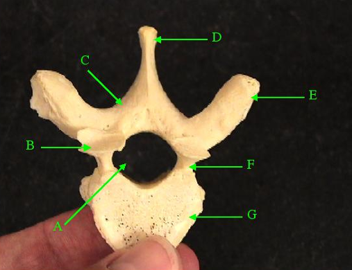 <p>Identify the structure labelled E. </p>