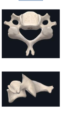 <ul><li><p>transverse processes have extra holes</p></li></ul><p></p>