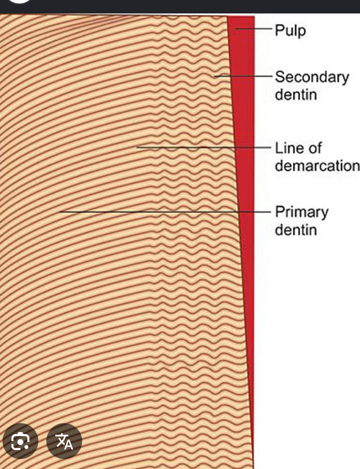 <p>What is the common shape of the secondary curvatures of the dentinal tubules</p>