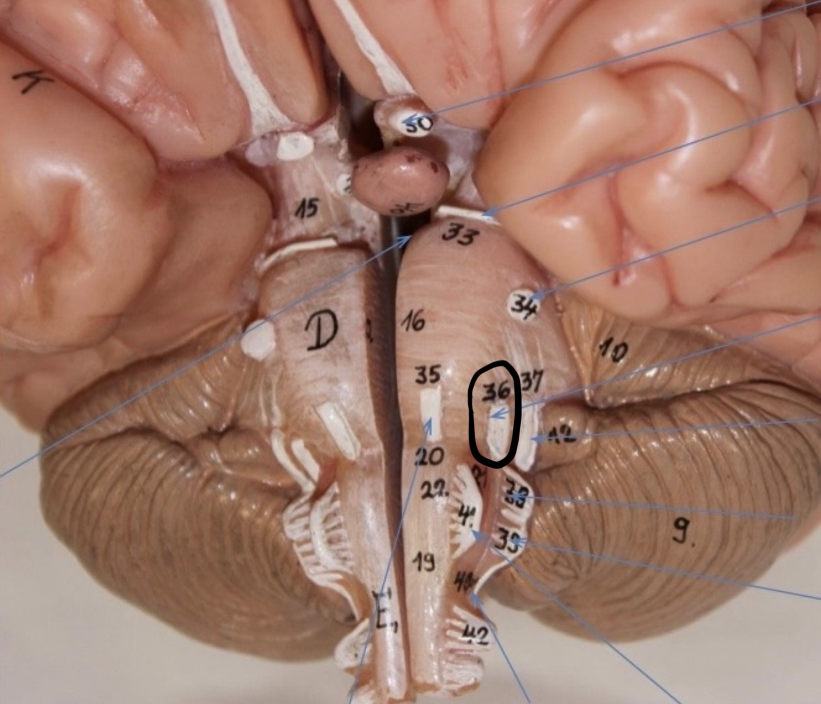 <p>Identify the circled area?</p>