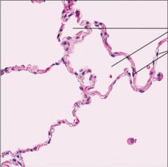 <p>name the tissue: single layer of flat cells with disc-shaped nuclei</p>