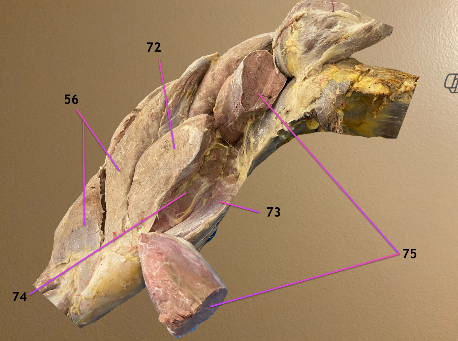 <p>lateral view, cranial to rt</p><p>.</p><p>label the parts of the quadriceps femoris: 72-74</p>