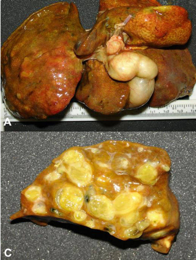 <p><span style="color: blue;"><em>Platynosomum fastosum</em></span> infections can cause this pictured? Disease clinical signs?</p>