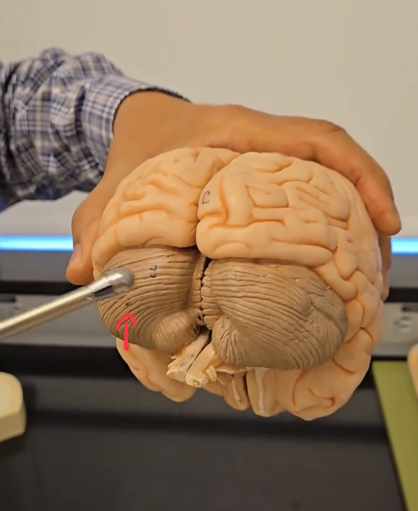 <p>Right cerebellar hemisphere.</p>