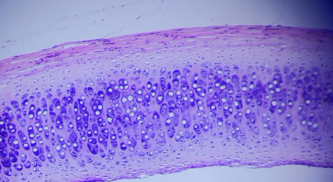 <p>What tissue type is present?</p>