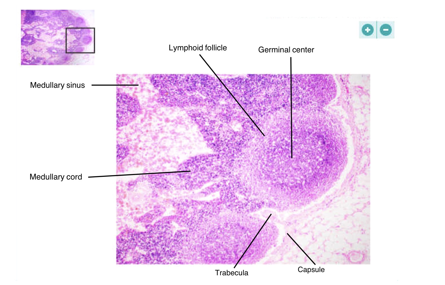 <p>Germinal center, capsule, medullary cords, lymphoid follicle</p>
