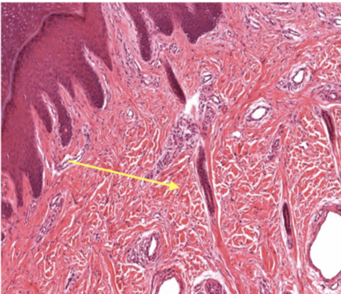 <p>Identify the specific layer</p>