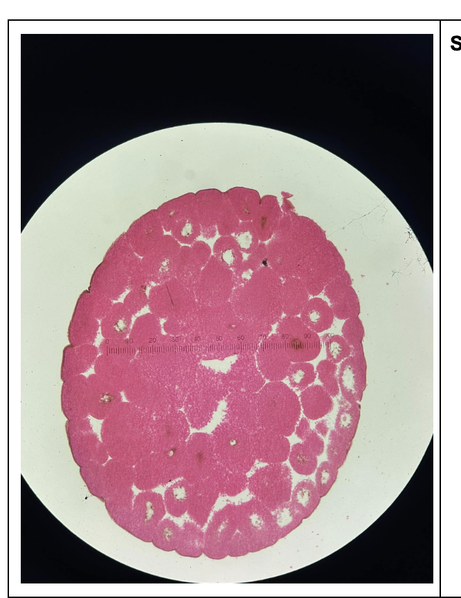 <p>what is the specimen?</p>