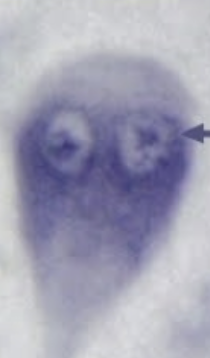 <p>What protists is this? (genus name)</p>