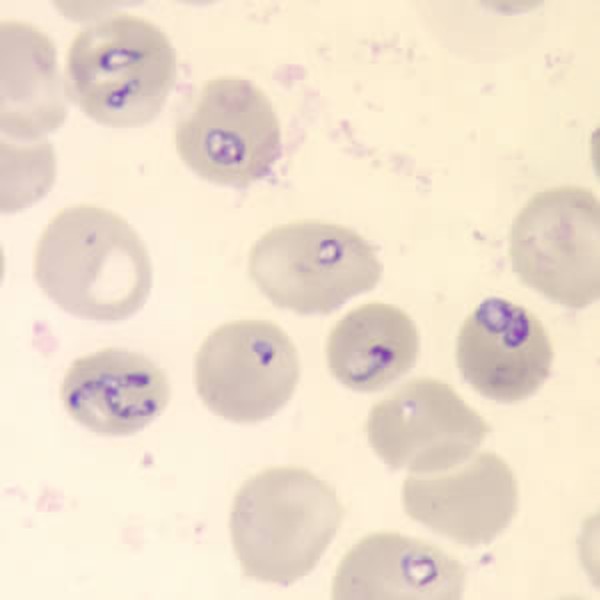 <p>Identify the organism</p>