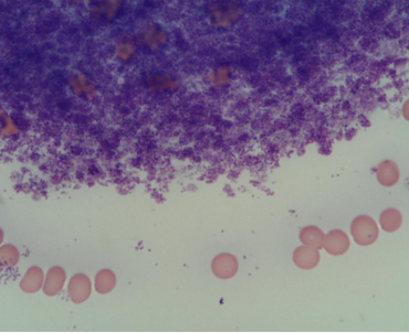 <p>K+ is released</p><p></p><p>Thrombocytosis may result in higher serum K+ </p><p>Prolonged contact of erythrocytes and serum (>2hours) may also increase K+ particularly with some dog breeds, horses and ruminants</p>