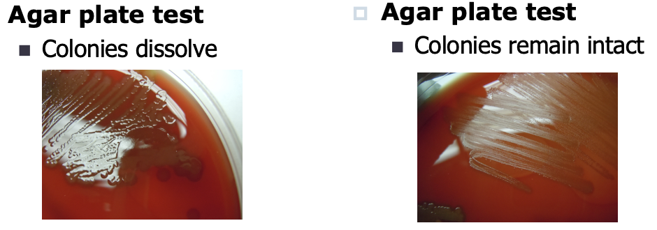<p>the principle is the same, the difference is that the plate will contain organism growth and a drop of bile solution (sodium deoxycholate) is added over a colony. If strep pneumoniae, the colonies will disintegrate.</p>