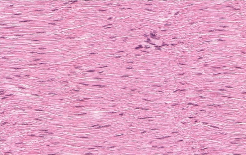 <p><span style="font-family: "Calibri Light";">Are elastic ligaments categorized as dense regular or dense irregular CT?</span></p>