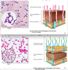 <p>What cell walls do prokaryotes have?</p>