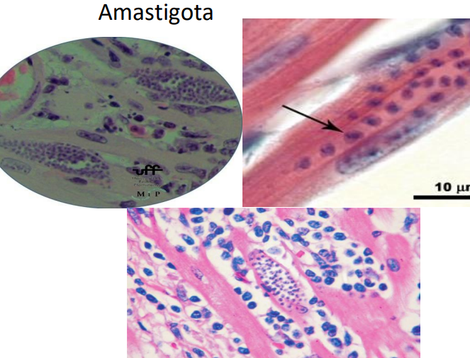 <p>Identifique a forma de vida e cite 3 sintomas de cada forma clínica </p>