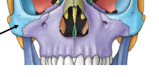<p>Zygomatic Bones</p>