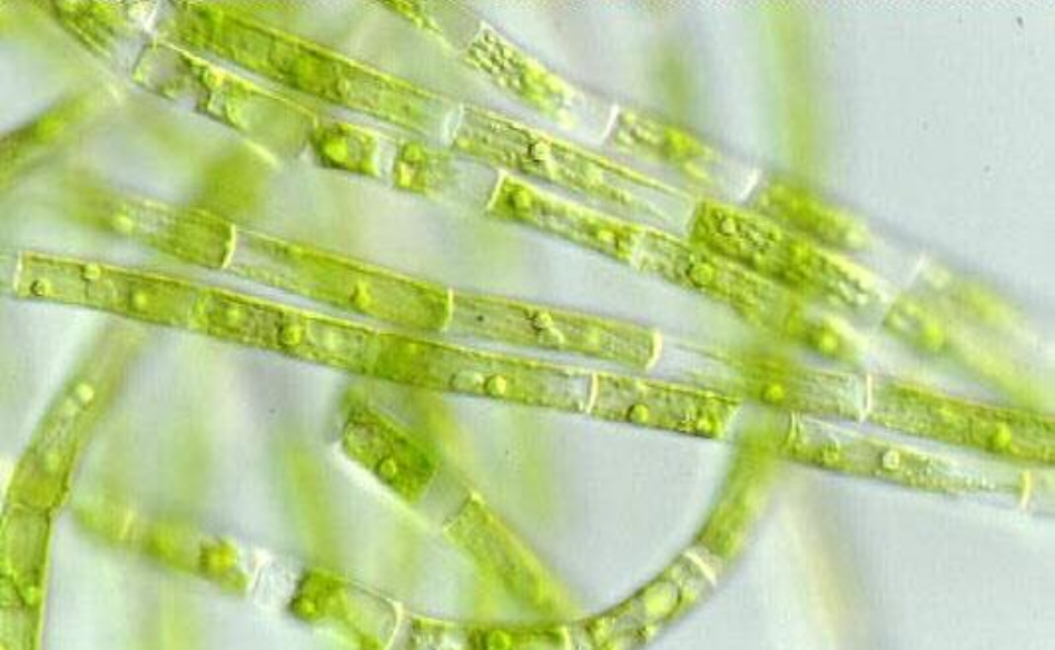 <p>Identify the genus of this Chlorophyta green algae.</p>