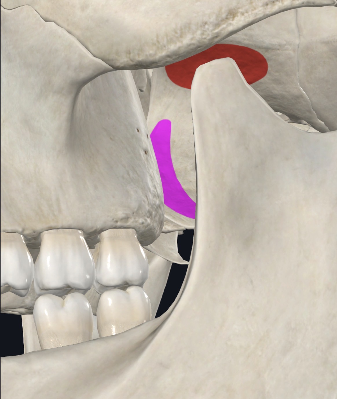 <p>Triangular two headed muscle from (1) infratemporal surface and crest of greater wing of sphenoid and (2) Surface of lateral pterygoid plate</p>