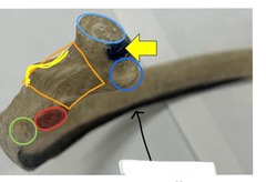<p>whats in orange</p>