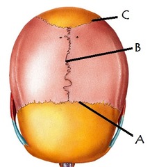 <p>Identify "A"</p>