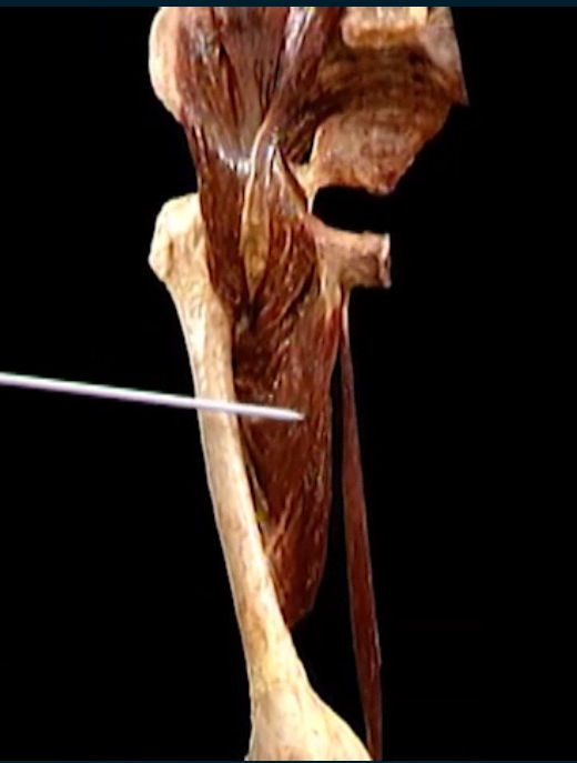 <p>Diep, anterior zicht</p>